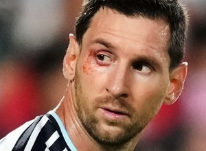 COMO SE ENCUENTRA MESSI LUEGO DE LA CLASIFICACIÓN A SEMIFINALES DEL MUNDIAL 2026
